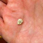 chinchilla bladder stone